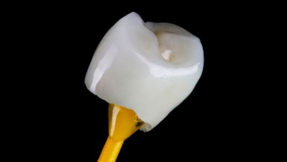 CEREC® an Incredible Invention